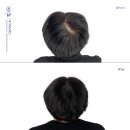 탈모왕 광주점 이미지