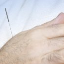 안태건한의원 이미지