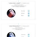 레이저솔루션 이미지