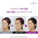 모앤