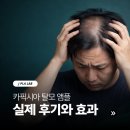 제이랩마케팅 | 탈모 두피 관리 앰플 카픽시아 실제 후기 모발 성장 효과