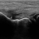 호수한의원 이미지