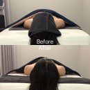 아르케조명 | 김해 내동 작은얼굴관리 트로이아르케 수분관리까지 받고 온 후기