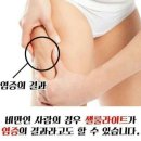 점핑퀸다이어트 네이버블로그