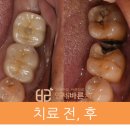 연세바른치과 이미지