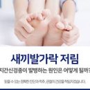 새끼발가락 저림 증상의 원인 이미지