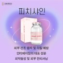 샤인멍 이미지