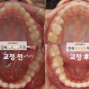 연세미소담은치과 이미지