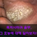 족저사마귀 율무, 그 효능에 대해 알아보자!! 이미지