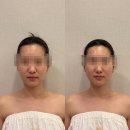 예쁜얼굴 | [청담경락 추천] 청담에스테틱 위뷰티청담점 예쁜얼굴 관리 후기 ㅣ 얼굴윤곽관리, 위뷰티청담점