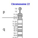 디조지 증후군 (DiGeorge Syndrome) 이미지