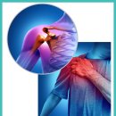 신통신경과의원 | 대구오십견치료 수술이 필요 없는 경우