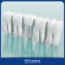 맥치과기공소 이미지