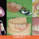 스마트덴탈치과기공소 이미지