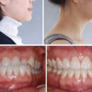 정의사 | 강남구청역치과? 교정 의사가 알려주는 선택 tip