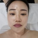 효행로 291번길 | 봉담에스테틱 라인뷰티어겐에서 리프팅 윤곽관리로 예뻐지고 가벼워진 후기