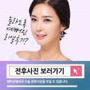 앤써성형외과의원 이미지