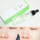 베쏘네일 이미지
