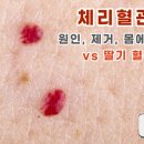 포두반점 이미지