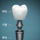 뿌리치과기공소 이미지