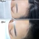 파인드어브로우(Find a brow) | [분당 야탑] M자 헤어라인 고민 해결은 파인드어브로우💓
