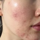 리부트짐(Reboot gym) | 아디즈 피부리부트 1기 1주차 기록 - 아디즈jy님