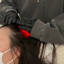 렛미인X모리바이브두피탈모