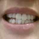 크린 앤화이트 이미지