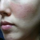 <b>퓨토</b> 이주일 사용후 대박.....