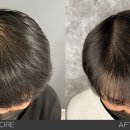 헤드샷스칼프본점 이미지