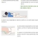 좌약 넣는법 변비 둘코락스 치질 및 써스펜 좌약 해열제 적응증 이미지