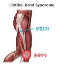 런닝하면서 필요한 족저근막, 발목, 정강이,장경인대 통증 개선 및 강화 스트레칭 이미지