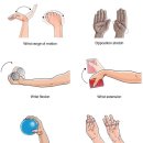 Fifth Metacarpal Fracture Rehabilitation Exercises 이미지