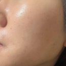 인더뷰티 | [서울/동작] 여드름 약 끊고 꾸준히 다닌 인더뷰티 내돈내산 후기 5회차