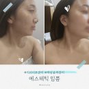 임쁨 | 하남 미사역 [에스테틱 임쁨] 하남 윤곽관리 예비신부관리 후기
