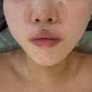 남양주에스테틱 가성비 좋은 별내왕비비에스테틱 피부관리 후기