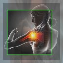 디클리셰 이미지