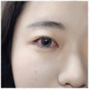 아미속눈썹