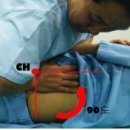 카이로프락틱 이미지