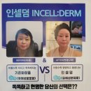 인셀덤비치나