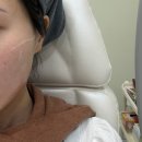 서면7 | 부산 온다리프팅 후기, 서면역 7번출구 한의원에서 받아본 탄력관리