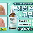 손톱양발톱군 | 메디프리스 멘틸락테이트 솔루션 멘틸스 효능, 부작용, 가격, 후기 총정리