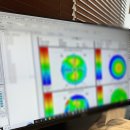 남10-3 | 테토남의 잠실 스마일라식 프로 당일수술 내돈내산 10개월 후 찐 후기