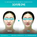 신부동산투자개발 | 광주피부관리] 봉선동 고운빛깔 에스테틱 광주점 예비 신부를 위한 프라이빗 광주웨딩관리 솔직 후기