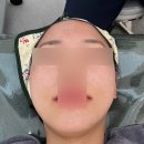 교육로 | [무안남악] ‘이솔에스테틱’ 무안피부관리맛집 플라즈마재생관리 후기