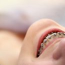 베네치아치과교정과치과의원 이미지