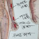 2.8 수태음폐경/열/허벅지/턱빠짐/목디스크/귀매미소리 이미지