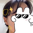 미소드림 | 내돈내산 이갈이 진료) 턱 보톡스, 측두근 보톡스, 이갈이 스플린트 강남미소드림치과 후기