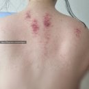 소망케어 | 청주 산전산후 해담바디케어 만삭 임산부 산전관리 후기