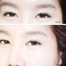 렌즈미동성로점 이미지